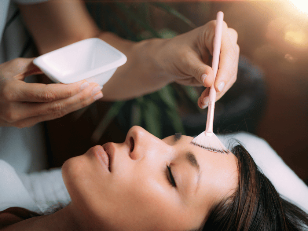 Chemical peel for acne treatment in Leawood KS to improve acne scars and uneven skin texture