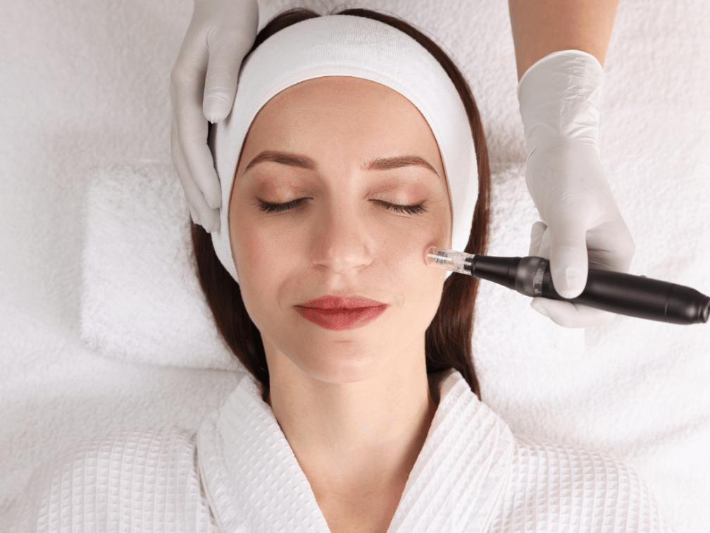 Client receiving nano needling skin treatment in Leawood KS for smoother, healthier skin